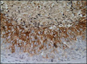 Anti-Carbonic Anhydrase IX antibody [GT12] used in IHC (Paraffin sections) (IHC-P). GTX70020